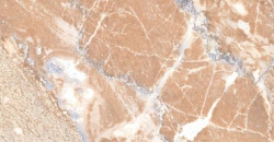Imistone